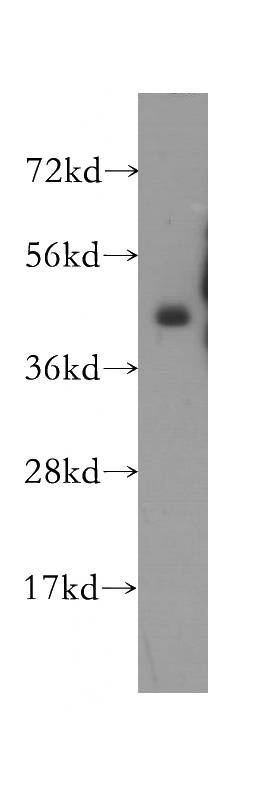mouse uterus tissue were subjected to SDS PAGE followed by western blot with Catalog No:112906(MVK antibody) at dilution of 1:500