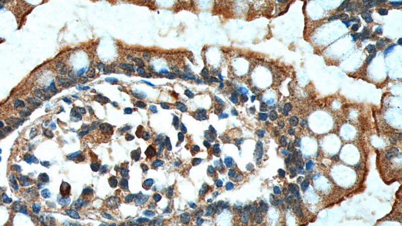 Immunohistochemistry of paraffin-embedded human small intestine tissue slide using Catalog No:111109(GPR128 Antibody) at dilution of 1:100 (under 40x lens).