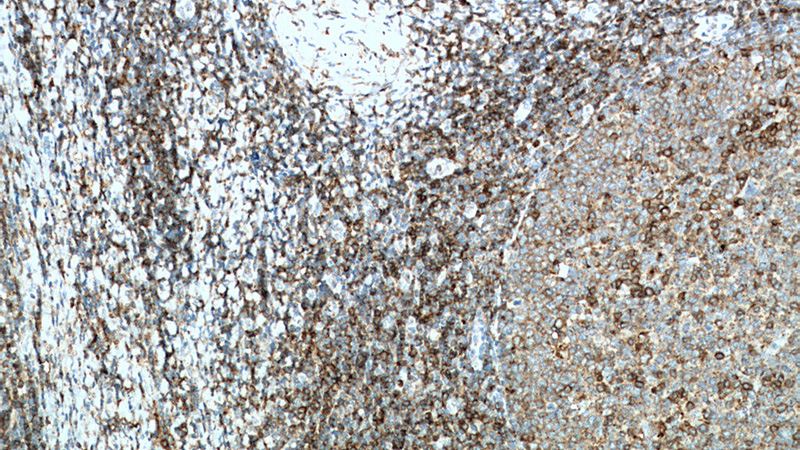 Immunohistochemistry of paraffin-embedded human tonsillitis tissue slide using Catalog No:107127(CD27 Antibody) at dilution of 1:200 (under 10x lens). heat mediated antigen retrieved with Tris-EDTA buffer(pH9).