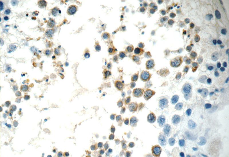 Immunohistochemistry of paraffin-embedded human testis tissue slide using Catalog No:110435(FAAH Antibody) at dilution of 1:50 (under 40x lens)