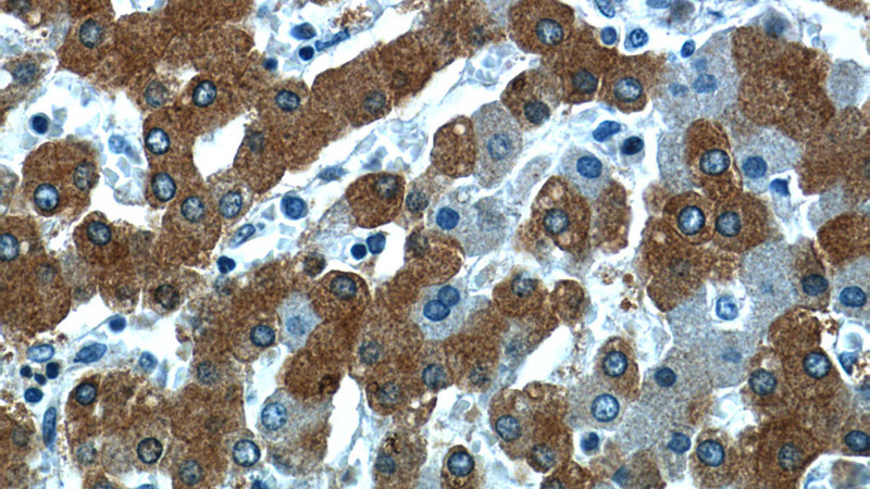 Immunohistochemistry of paraffin-embedded human liver slide using Catalog No:114685(RELN Antibody) at dilution of 1:50(under 40x lens)