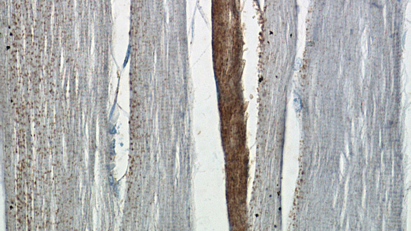 Immunohistochemistry of paraffin-embedded human skeletal muscle tissue slide using Catalog No:114606(RBM24 Antibody) at dilution of 1:50 (under 40x lens)