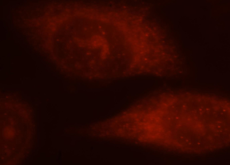 Immunofluorescent analysis of Hela cells, using ALOX5 antibody Catalog No:107662 at 1:25 dilution and Rhodamine-labeled goat anti-rabbit IgG (red).