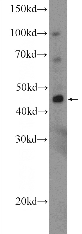 mouse brain tissue were subjected to SDS PAGE followed by western blot with Catalog No:112753(MPPE1 Antibody) at dilution of 1:300