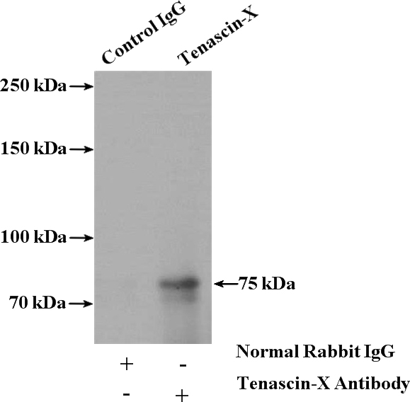IP Result of anti-TNXB (IP:Catalog No:115945, 4ug; Detection:Catalog No:115945 1:300) with mouse liver tissue lysate 4000ug.