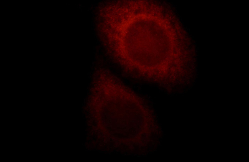 Immunofluorescent analysis of Hela cells, using SSSCA1 antibody Catalog No:115611 at 1:25 dilution and Rhodamine-labeled goat anti-rabbit IgG (red).