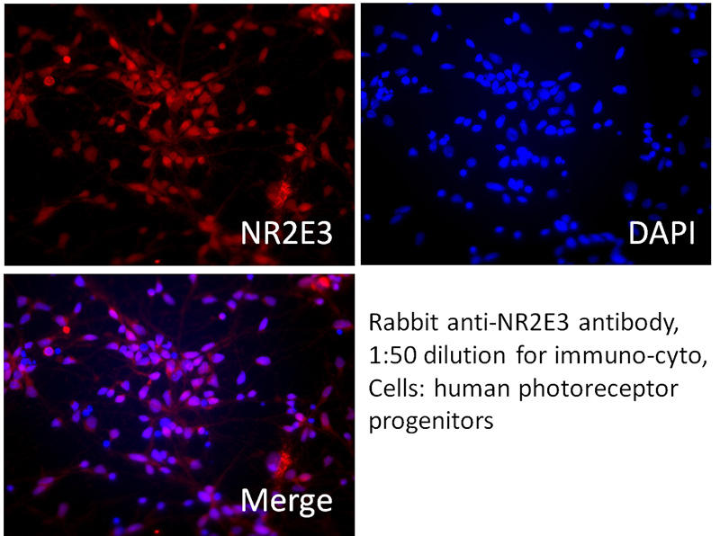 IF result of NR2E3 antibody (Catalog No:113266, 1:50) with human photoreceptor progenitors cells.