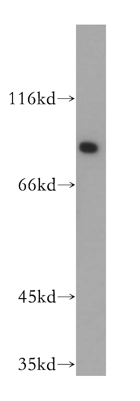 HEK-293 cells were subjected to SDS PAGE followed by western blot with Catalog No:110855(AP1G1 antibody) at dilution of 1:400
