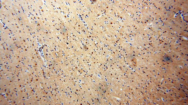 Immunohistochemical of paraffin-embedded human brain using Catalog No:116483(TUB antibody) at dilution of 1:100 (under 10x lens)