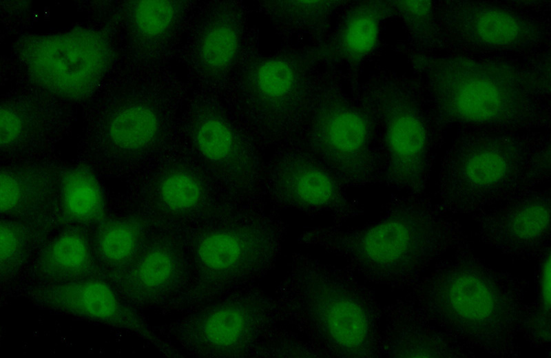 Immunofluorescent analysis of (10% Formaldehyde) fixed SH-SY5Y cells using Catalog No:117177(ZNF446 Antibody) at dilution of 1:50 and Alexa Fluor 488-congugated AffiniPure Goat Anti-Rabbit IgG(H+L)