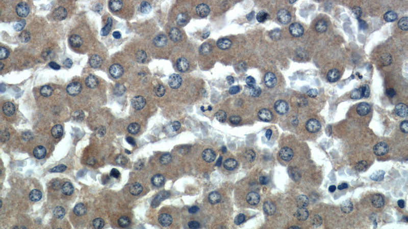 Immunohistochemical of paraffin-embedded human liver using Catalog No:107895(ADRP antibody) at dilution of 1:50 (under 40x lens)