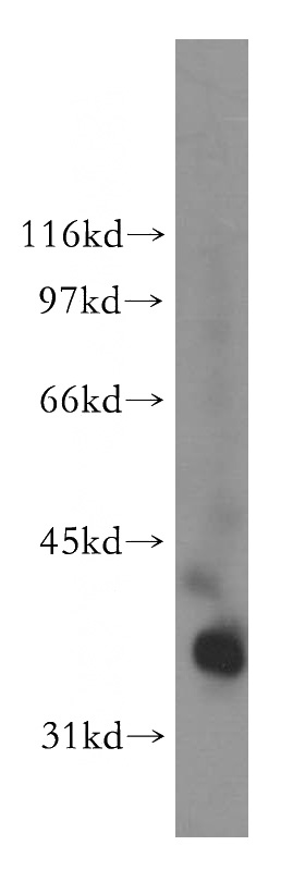 human heart tissue were subjected to SDS PAGE followed by western blot with Catalog No:113630(PDLIM3 antibody) at dilution of 1:500