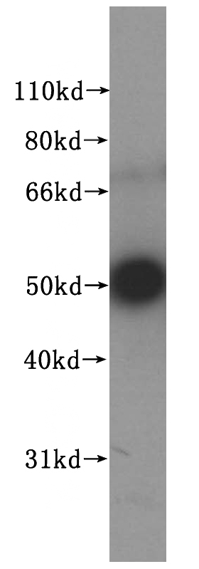 HEK-293 cells were subjected to SDS PAGE followed by western blot with Catalog No:113365(NUF2 antibody) at dilution of 1:500