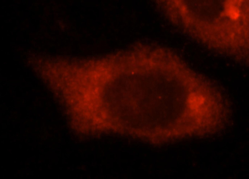 Immunofluorescent analysis of Hela cells, using SLC7A4 antibody Catalog No:115348 at 1:25 dilution and Rhodamine-labeled goat anti-rabbit IgG (red).