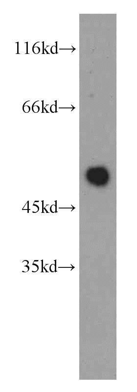 Y79 cells were subjected to SDS PAGE followed by western blot with Catalog No:113125(NEUROD1 antibody) at dilution of 1:200