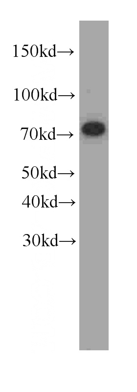 K-562 cells were subjected to SDS PAGE followed by western blot with Catalog No:107282(FUS antibody) at dilution of 1:1000