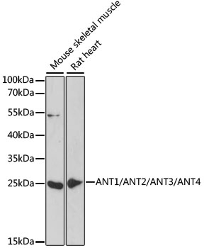 Western blot - ANT1/ANT2/ANT3/ANT4 Polyclonal Antibody 