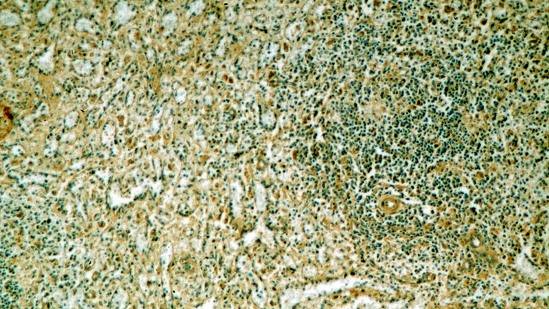 Immunohistochemical of paraffin-embedded human spleen using Catalog No:113471(POU2F2-Specific antibody) at dilution of 1:100 (under 10x lens)