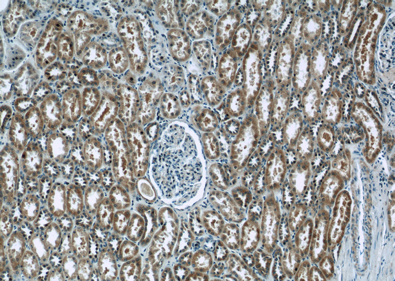 Immunohistochemistry of paraffin-embedded human kidney tissue slide using Catalog No:110177(EIF1B Antibody) at dilution of 1:50 (under 10x lens)
