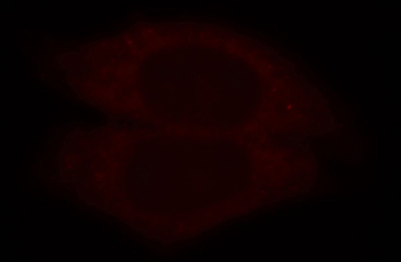 Immunofluorescent analysis of HepG2 cells, using PRPS1 antibody Catalog No:114237 at 1:25 dilution and Rhodamine-labeled goat anti-rabbit IgG (red).