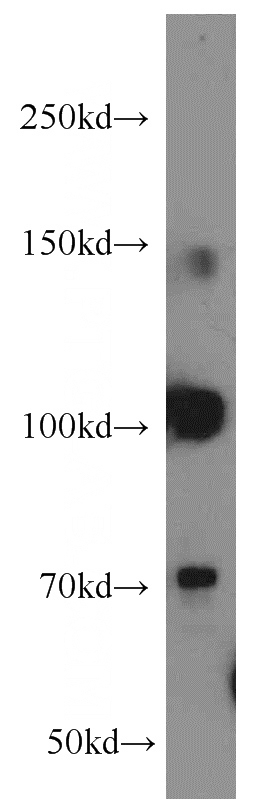 HeLa cells were subjected to SDS PAGE followed by western blot with Catalog No:114600(RBM15B antibody) at dilution of 1:2000