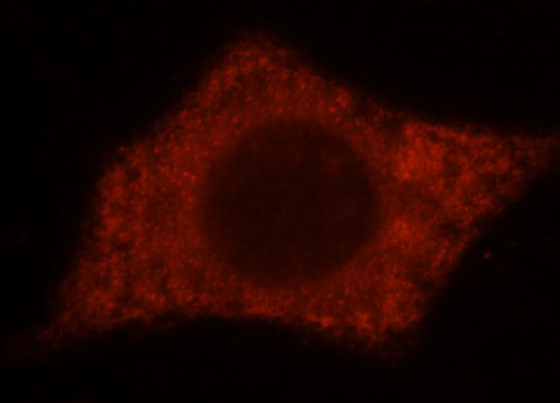 Immunofluorescent analysis of Hela cells, using ERP44 antibody Catalog No:116451 at 1:25 dilution and Rhodamine-labeled goat anti-rabbit IgG (red).