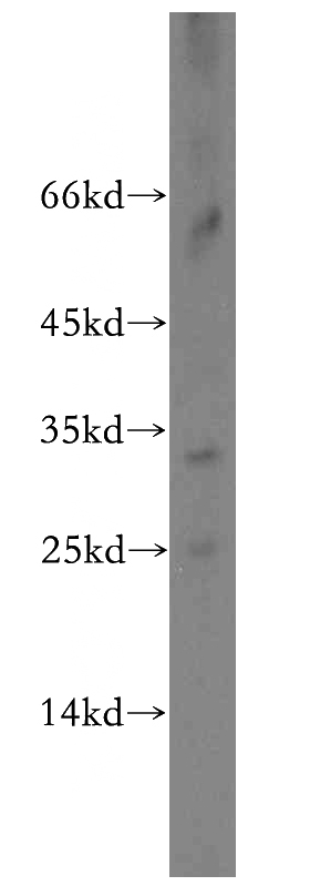 Sp2/0 cells were subjected to SDS PAGE followed by western blot with Catalog No:114435(RAB37 antibody) at dilution of 1:100
