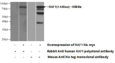 Transfected HEK-293 cells were subjected to SDS PAGE followed by western blot with Catalog No:114523(RAF1 Antibody) at dilution of 1:1000