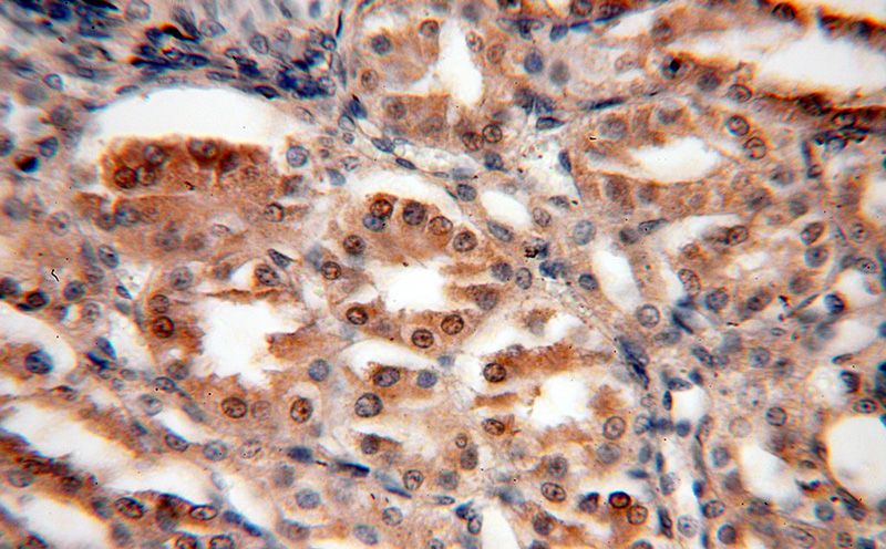 Immunohistochemical of paraffin-embedded human kidney using Catalog No:115250(SIX2 antibody) at dilution of 1:50 (under 40x lens)
