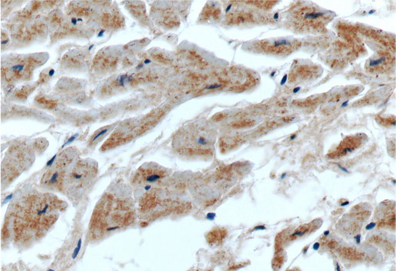 Immunohistochemistry of paraffin-embedded human heart tissue slide using Catalog No:115112(SEPN1 Antibody) at dilution of 1:50 (under 40x lens)