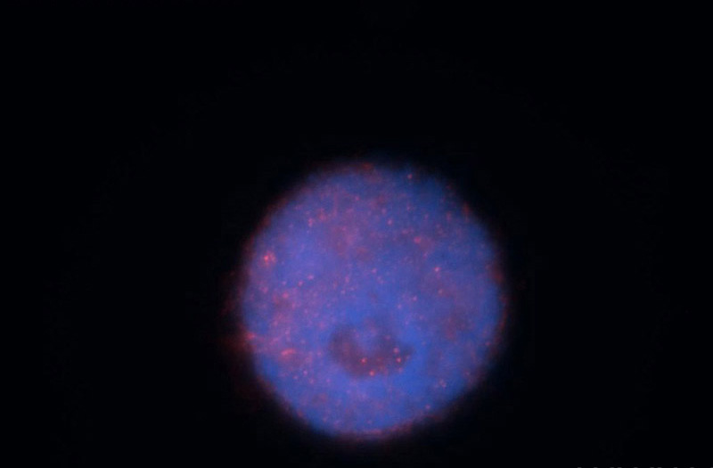 Immunofluorescent analysis of Hela cells, using RNMT antibody Catalog No:114768 at 1:50 dilution and Rhodamine-labeled goat anti-rabbit IgG (red). Blue pseudocolor = DAPI (fluorescent DNA dye).
