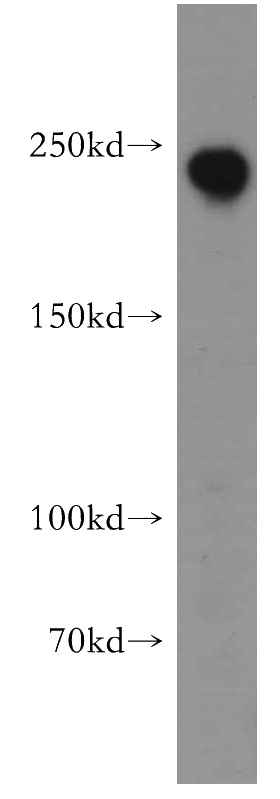 HepG2 cells were subjected to SDS PAGE followed by western blot with Catalog No:117259(ZO1 antibody) at dilution of 1:500
