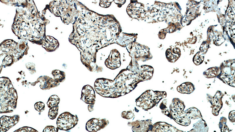 Immunohistochemical of paraffin-embedded human placenta using Catalog No:115419(SMAD4 antibody) at dilution of 1:50 (under 10x lens)