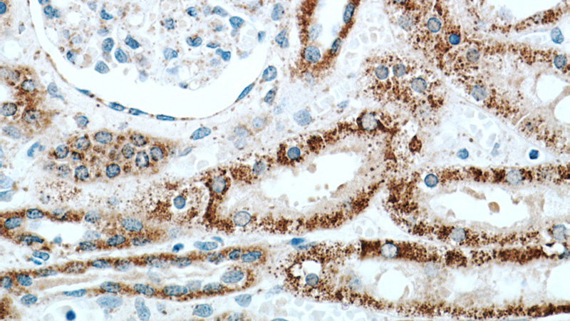 Immunohistochemical of paraffin-embedded human kidney using Catalog No:111845(INPP5J antibody) at dilution of 1:50 (under 40x lens)