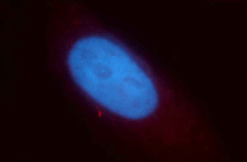 Immunofluorescent analysis of HepG2 cells, using MLXIP antibody Catalog No:112687 at 1:25 dilution and Rhodamine-labeled goat anti-rabbit IgG (red). Blue pseudocolor = DAPI (fluorescent DNA dye).