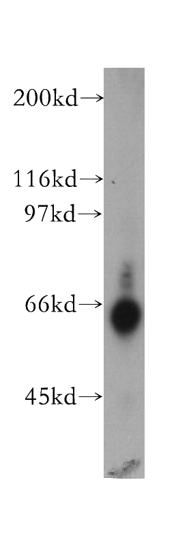 human brain tissue were subjected to SDS PAGE followed by western blot with Catalog No:115922(TDG antibody) at dilution of 1:400