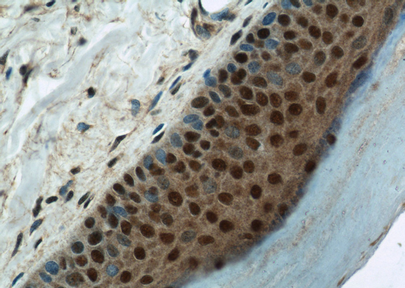 Immunohistochemical of paraffin-embedded human skin using Catalog No:112734(MORF4L1 antibody) at dilution of 1:100 (under 40x lens)