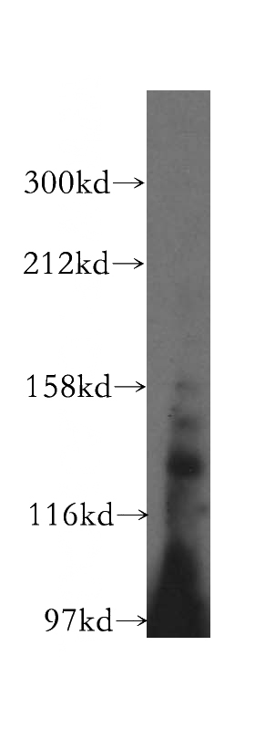 mouse kidney tissue were subjected to SDS PAGE followed by western blot with Catalog No:115022(SCUBE3 antibody) at dilution of 1:300