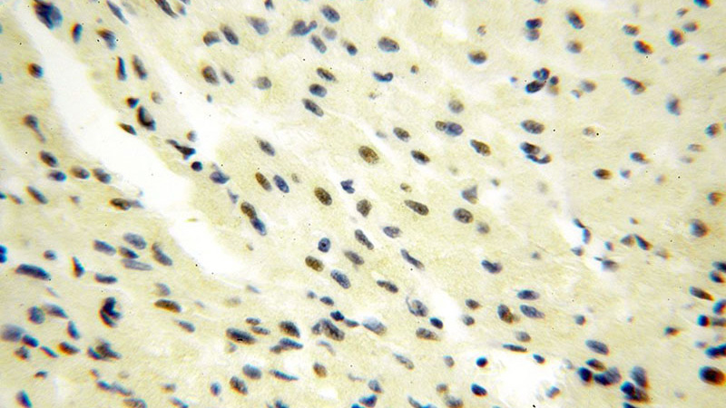 Immunohistochemical of paraffin-embedded human heart using Catalog No:111237(GTF2IRD1 antibody) at dilution of 1:100 (under 40x lens)