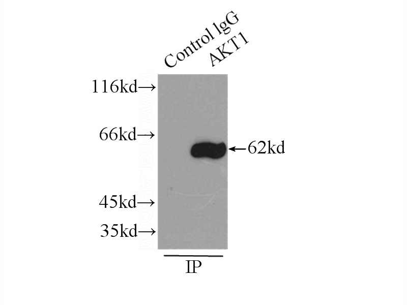 IP Result of anti-AKT (IP:Catalog No:107948, 3ug; Detection:Catalog No:107948 1:500) with HeLa cells lysate 2500ug.