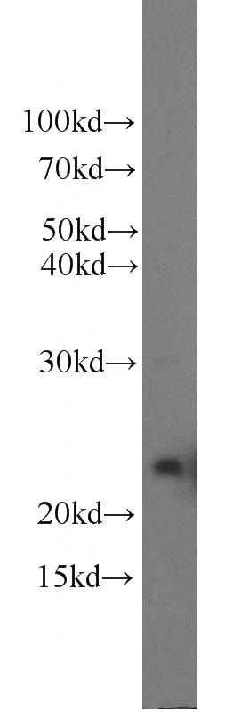 human placenta tissue were subjected to SDS PAGE followed by western blot with Catalog No:110963(GH2 antibody) at dilution of 1:300