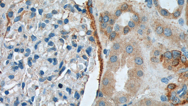 Immunohistochemistry of paraffin-embedded human kidney tissue slide using Catalog No:108700(C20orf3 Antibody) at dilution of 1:200 (under 40x lens).