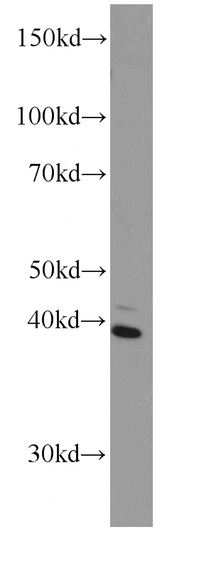 human brain tissue were subjected to SDS PAGE followed by western blot with Catalog No:107079(BBS5 antibody) at dilution of 1:1000