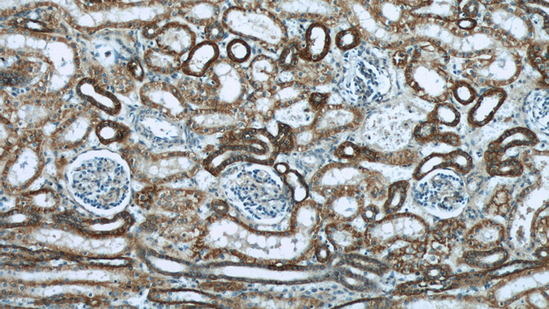 Immunohistochemical of paraffin-embedded human kidney using Catalog No:108341(ATP1A1 antibody) at dilution of 1:100 (under 10x lens)
