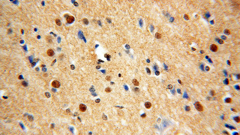 Immunohistochemical of paraffin-embedded human brain using Catalog No:116483(TUB antibody) at dilution of 1:100 (under 40x lens)