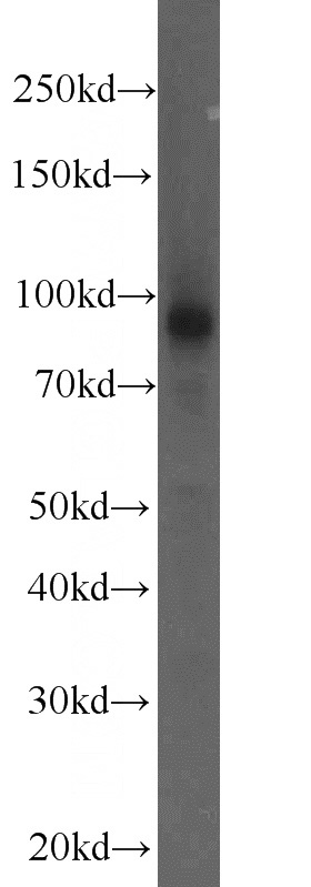 human placenta tissue were subjected to SDS PAGE followed by western blot with Catalog No:109273(CHPF antibody) at dilution of 1:1000
