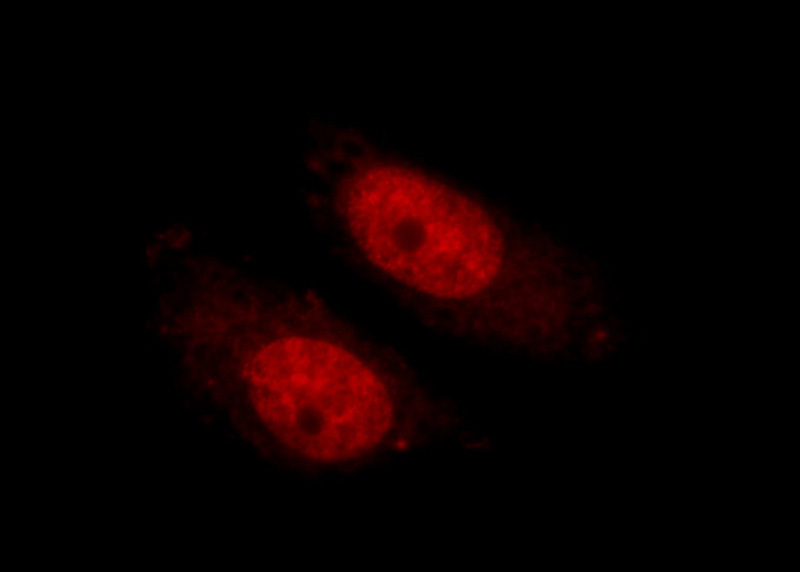 Immunofluorescent analysis of HepG2 cells using Catalog No:110205(EFCAB5 Antibody) at dilution of 1:25 and Rhodamine-Goat anti-Rabbit IgG