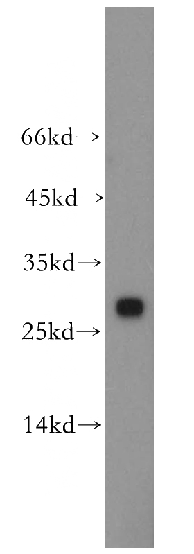 HeLa cells were subjected to SDS PAGE followed by western blot with Catalog No:109412(CMBL antibody) at dilution of 1:200