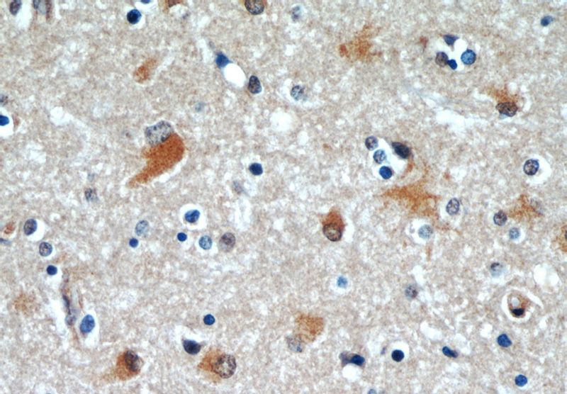 Immunohistochemical of paraffin-embedded human brain using Catalog No:107029(C9orf72 antibody) at dilution of 1:50 (under 40x lens)