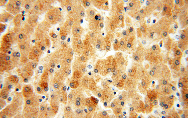 Immunohistochemical of paraffin-embedded human liver using Catalog No:109240(CHKA antibody) at dilution of 1:50 (under 40x lens)